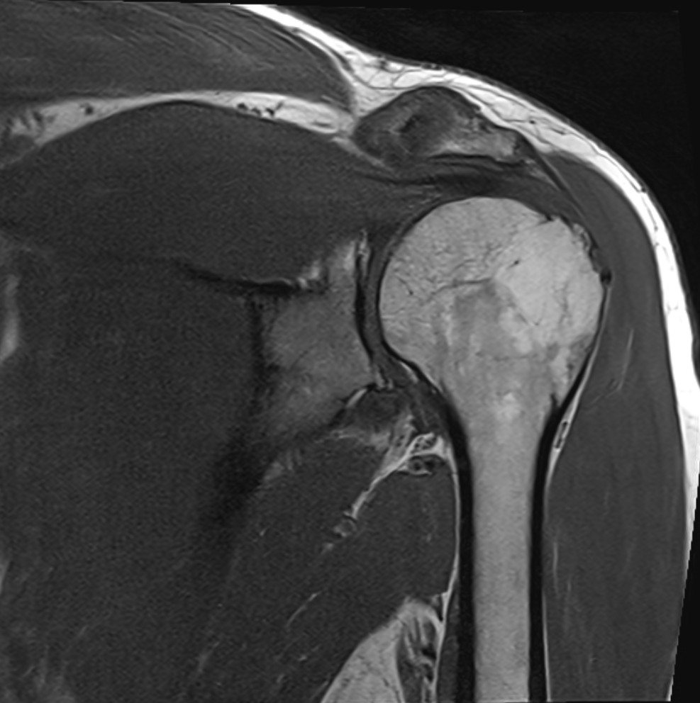 MRI bark – podstawowy